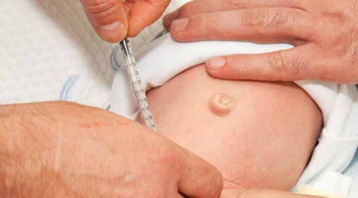 How Long Does It Take For A Circumcision To Heal? How Long Does It Take For A Circumcision To Heal?