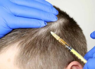 Bad Line Up- How to fix a push-back hairline? Bad Line Up