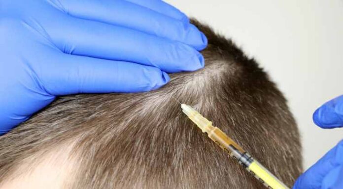 Bad Line Up- How to fix a push-back hairline? Bad Line Up